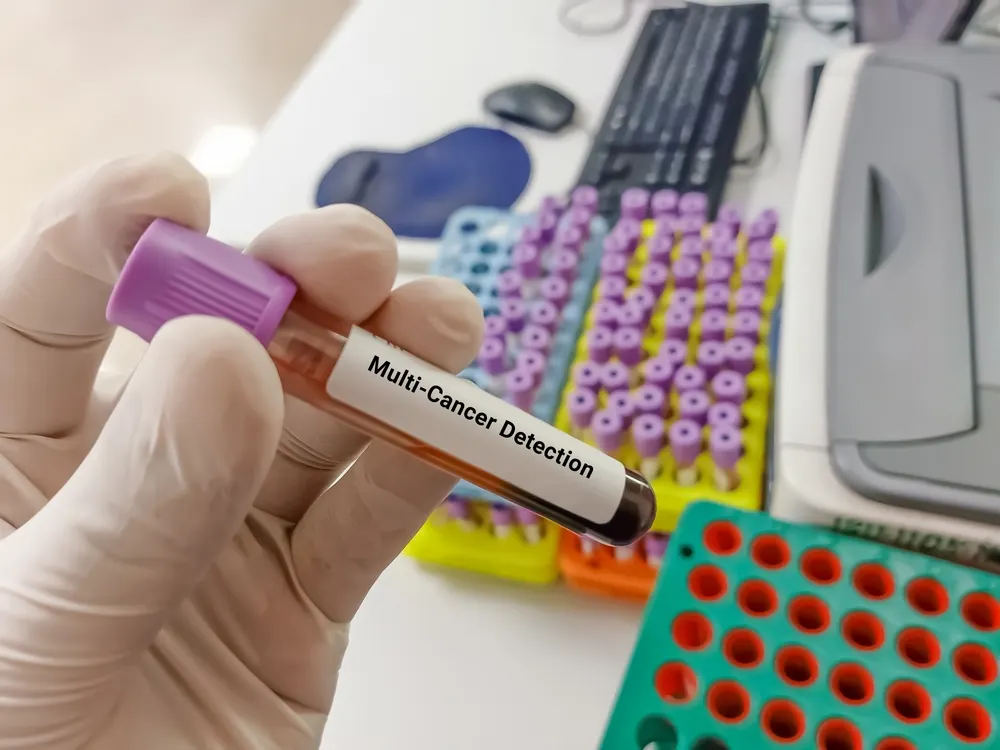Multi-Cancer Blood Testing: What Galleri Means for Early Detection