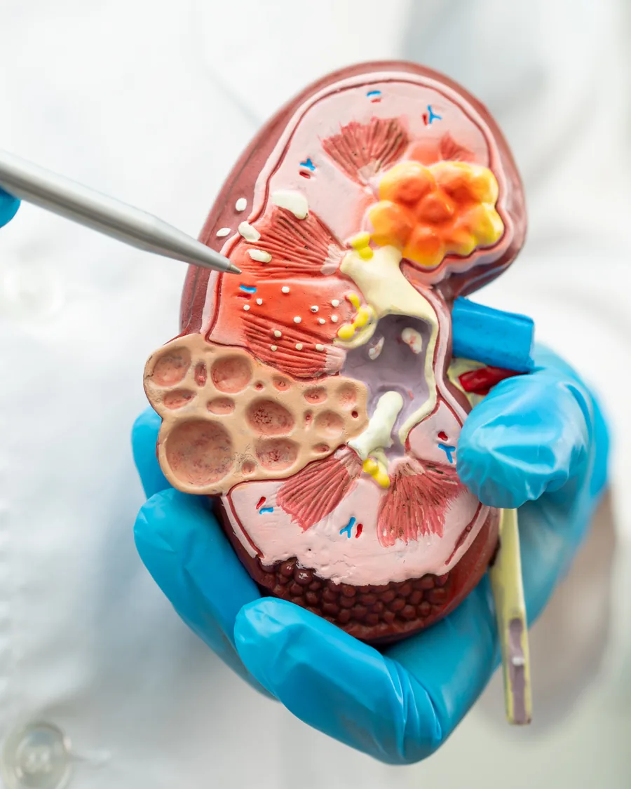 An anatomical model of a kidney in a clinical setting.