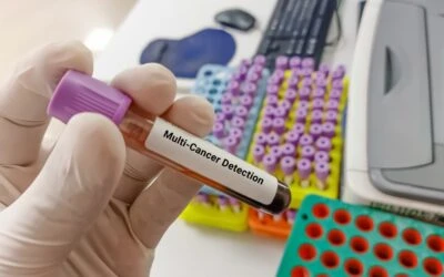 Multi-Cancer Blood Testing: What Galleri Means for Early Detection